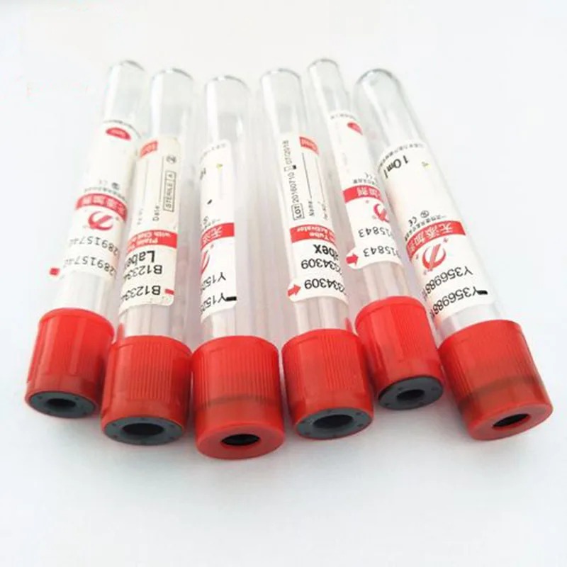 100pcs Disposable Vacuum Blood - Blood Collection Tube review and price