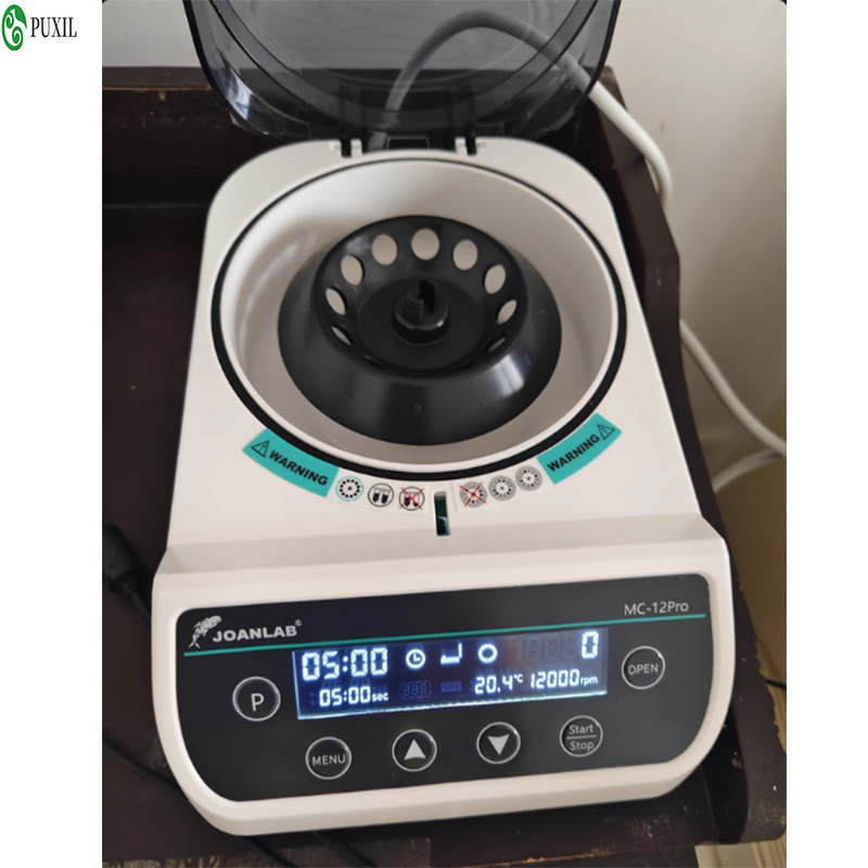 AB plasma centrifuge laborator - Blood Collection Tube review and price